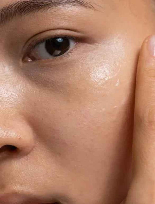 How To Get Better Skin In 2 Weeks: The Ultimate Hydration Reset Your Skin Needs - SheShiny Co